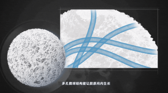 深圳联合丽格谈：再生材料胶原直补 再现童颜(图8)